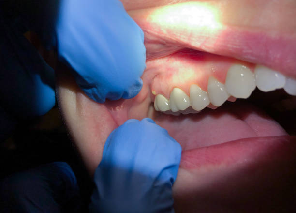 Best Emergency Denture Repair in Mcnair, VA