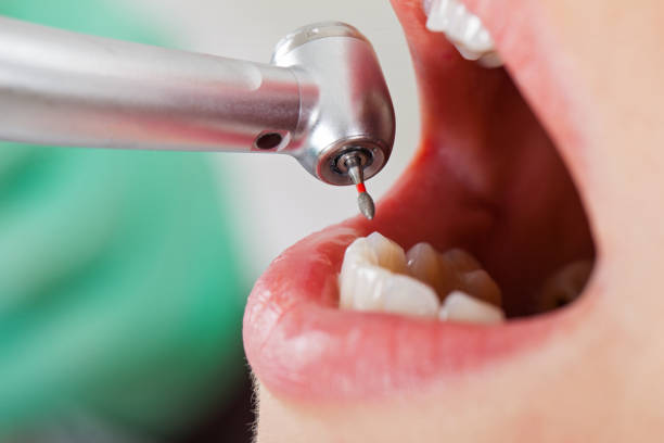 Best Emergency Treatment for Dental Infections or Abscesses in Mcnair, VA
